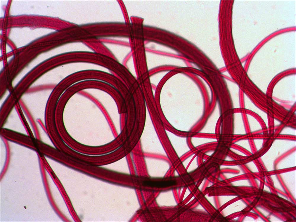 Кошачья шерсть под микроскопом Кошачья шерсть под микроскопом